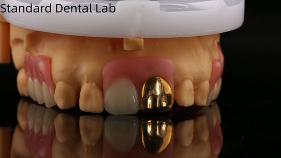 دندان مصنوعی آکریلیک کامل با دندان های طلایی زرد/ دندان مصنوعی آکریلیک موقت Ivoclar حرفه ای FDA تایید شده
