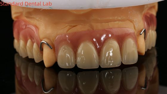 لابراتوار دندانپزشکی آکریلیک قسمتی ایوکلار با دقت بالا با مدل چاپ سه بعدی