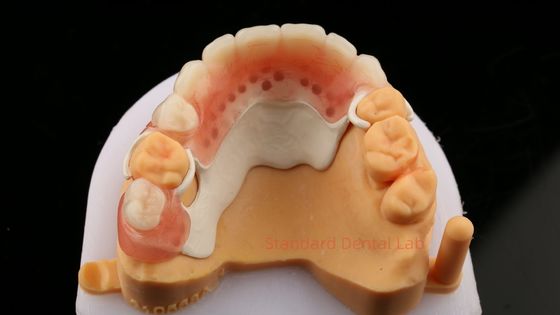 Peek طراحی چارچوب جزئی ISO CE و FDA آزمایشگاه دندانپزشکی آکریلیک چارچوب دندان مصنوعی جزئی