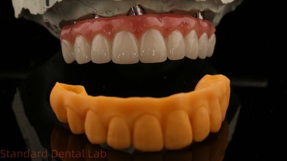 5 سال گارانتی ایمپلنت دندانی تاج PMMA پل بیش از چند واحد Abutments سفارشی Vita سایه