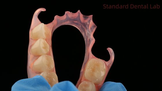 دندانپزشکی TCS Valplast انعطاف پذیر دندان های مصنوعی دندانپزشکی آزمایشگاه چاپ 3D مدل زیبایی بالا