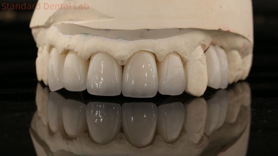 چین آزمایشگاه دندانپزشکی زرکونیا تاج کامل کنتور زیبایی بالا پل طبیعی دندانپزشکی 5 سال گارانتی