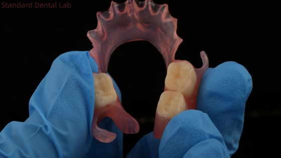 دندانپزشکی TCS Valplast پروتز های جزئی انعطاف پذیر Nesbit Valplast Finish