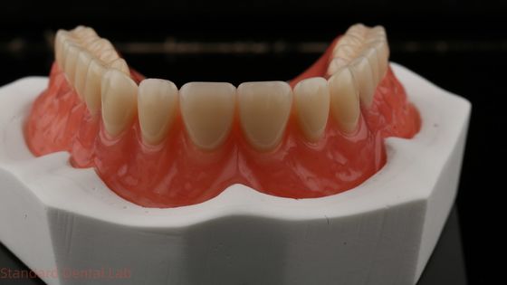 دندانهاي دندانهاي دندانهاي دندانهاي دندانهاي دندانهاي دندانهاي دندانهاي دندانهاي دندانهاي دندانهاي دندانهاي دندانهاي