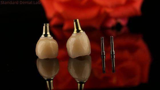 سیمان زرکونیا پورسلین ایمپلنت پیچ نگه داشته شده شکل شش گوشه ای سر برای زیبایی مناسب سفارشی
