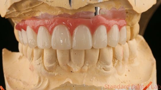 مناسب خوب دقیق زیبایی زیرکونیا برزیلین تاج برزیلین صورتی با سایه سفید کننده