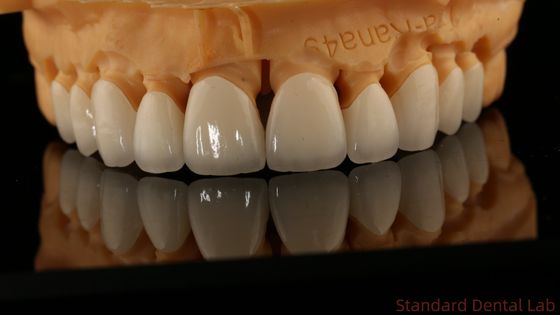 تاج های لابراتوار دندانپزشکی Full Contour تاج های لابراتوار دندانپزشکی چین