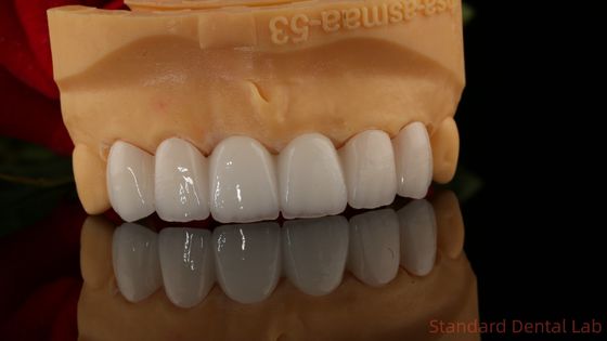 کل کنتور تاج زرکونیا شفافیت 3D پرو بدون پوشش پورسلین آزمایشگاه دندانپزشکی استاندارد