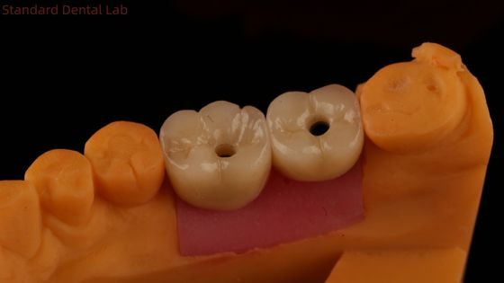 نام