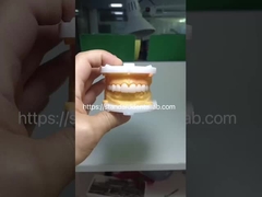 بروکس زیر با شکل کامل تاج زرکونیا پل PFZ