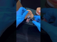 چارچوب روشن آکریلیک فلزی چارچوب دندان مصنوعی جزئی زیبایی بالا آزمایشگاه دندانپزشکی چین