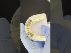 فلزی Cast Post Core Crown Cocr Accurate Retentive Full Zirconia Bruxier از سنگ زرکونیا استفاده می شود