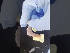 دندانهای انعطاف پذیر Valplast برای راحتی طبیعی و کیفیت زیبایی