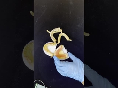 دندانهاي دندانهاي دندانهاي دندانهاي دندانهاي دندانهاي دندانهاي دندانهاي دندانهاي دندانهاي دندانهاي دندانهاي دندانهاي