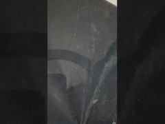 دندان های مصنوعی با ایمپلنت تیتانیوم