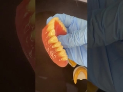 مکمل بالا و پایین استیپ پلیت آکریلیک دندان های مصنوعی جزئی دندانهای ایوکلار آدامس صورتی