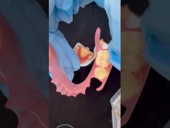 مدل چاپ سه بعدی زیبایی بالا دندان TCS Valplast انعطاف پذیر دندان های مصنوعی دندان آزمایشگاه